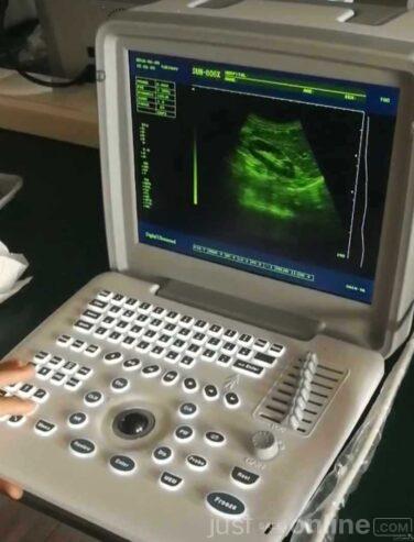 Table Top Ultrasound Scanning Machine