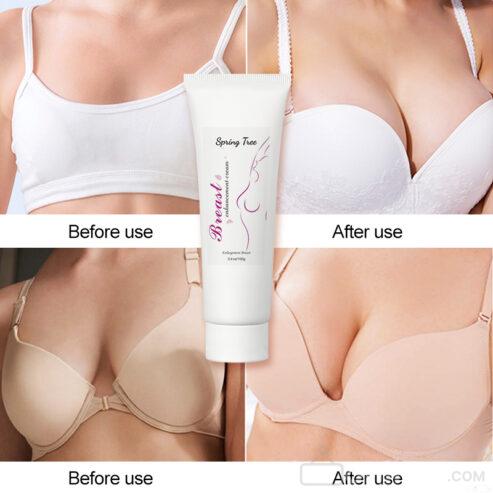 SPRING TREE breast enlargement cream